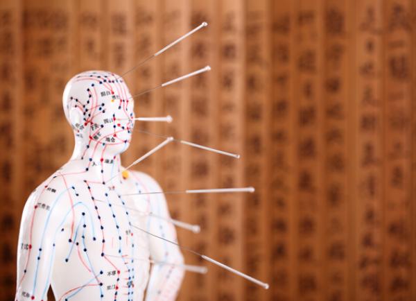 Acupuncture : Un remède naturel contre la douleur