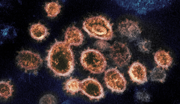 Le coronavirus présente des protéines pointues (appelées spicules), qu’il utilise pour infecter les cellules hôtes. (Image : Galerie d’images NIH / CC0 1.0)
