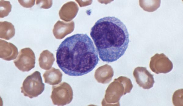 Les monocytes sont des globules blancs qui aident les lymphocytes à reconnaître les germes. (Image : Graham Beards / wikimedia / CC BY-SA 3.0)