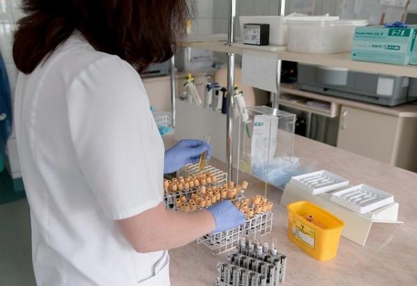 Les chercheurs ont analysé 37 échantillons de lait provenant de 18 femmes diagnostiquées positives à la Covid-19. Aucun des échantillons de lait ne contenait le virus, mais près des deux tiers des échantillons contenaient deux anticorps spécifiques au virus. (Image : Michal Jarmoluk / Pixabay)