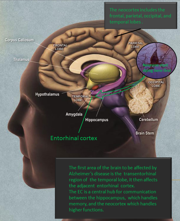 Le soutien émotionnel, un remède pour booster le cerveau et prévenir le déclin cognitif 