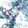 Le nombre de décès dus aux infections fongiques dans le monde a doublé en dix ans selon une nouvelle étude
